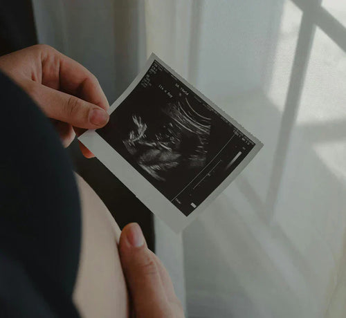 Femme tenant une échographie de son futur bébé dans les mains. - Mustela Belgium - 1