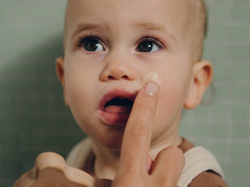 Application du Baume universel sur le visage d'un enfant ayant de l'eczéma - Mustela Belgium - 9