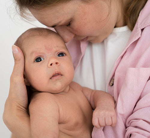 Eczéma du bébé : reconnaître et soigner la peau atopique - Mustela Belgium - 1