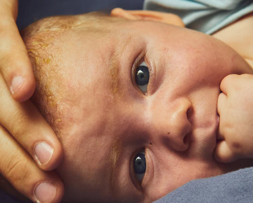 soins-nouveau-ne-mustela_8a3c5a08-4f22-468a-b7b1-b44eb6a30518 - Mustela Belgium - 1